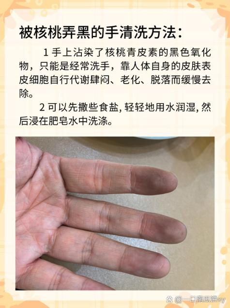 開核桃為什麼手會黑:探究核桃讓手變色的秘密與預防方法 3 開核桃為什麼手會黑