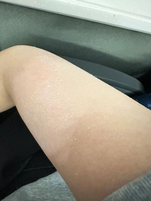 身體去角質會變白嗎