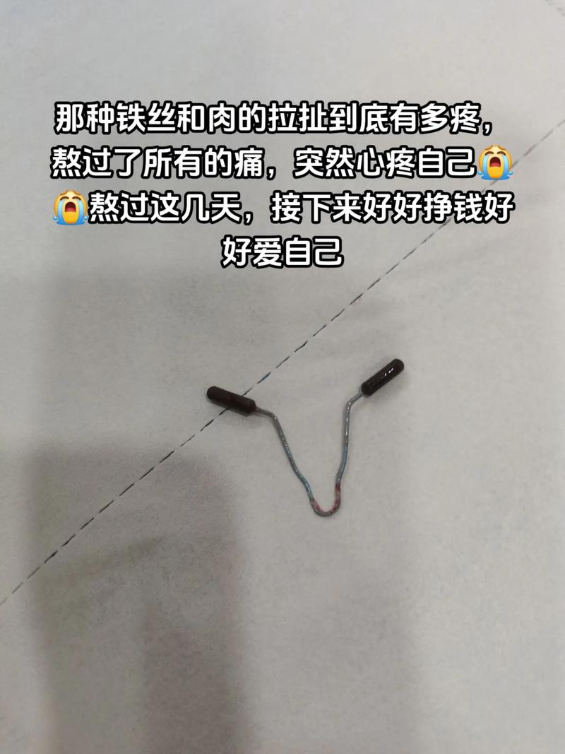 懷孕肚臍環要拆掉嗎