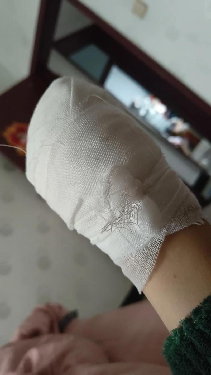 紗布吞下去怎麼辦