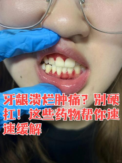 牙齦長牙齒怎麼辦