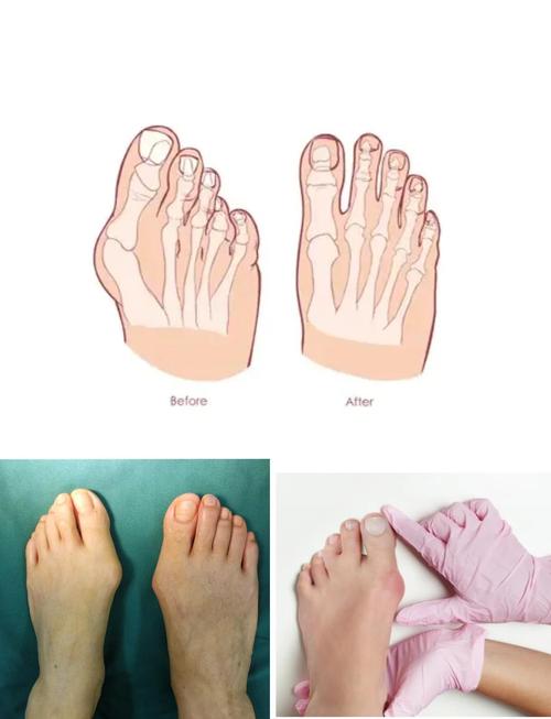 如何矯正走路姿勢