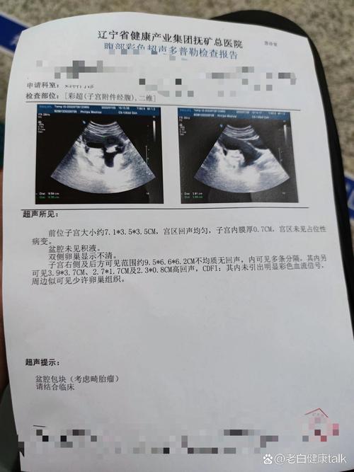 畸胎瘤手術費用:深度解析台灣婦科手術的成本構成與注意事項 1 畸胎瘤手術費用
