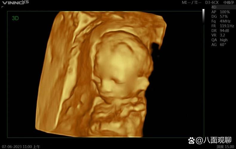 17週胎兒:發展里程碑、媽媽變化與重要注意事項全解析 3 17週胎兒