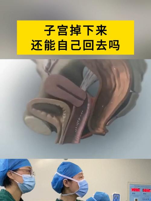 子宮拿掉為什麼還有血
