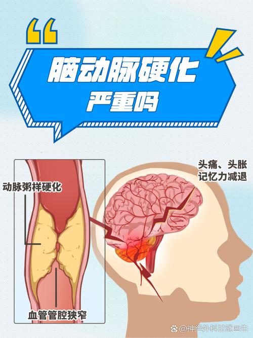 動脈硬化可以恢復嗎