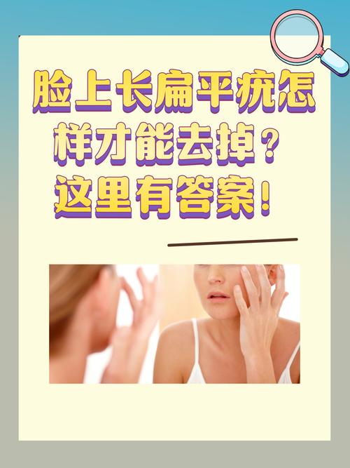 臉上長疣怎麼辦:專業醫師解析、治療與預防全攻略 3 臉上長疣怎麼辦