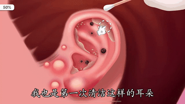 如何判斷耳朵裡有沒有蟲:深入解析症狀、原因、居家處理及何時該就醫 1 如何判斷耳朵裡有沒有蟲