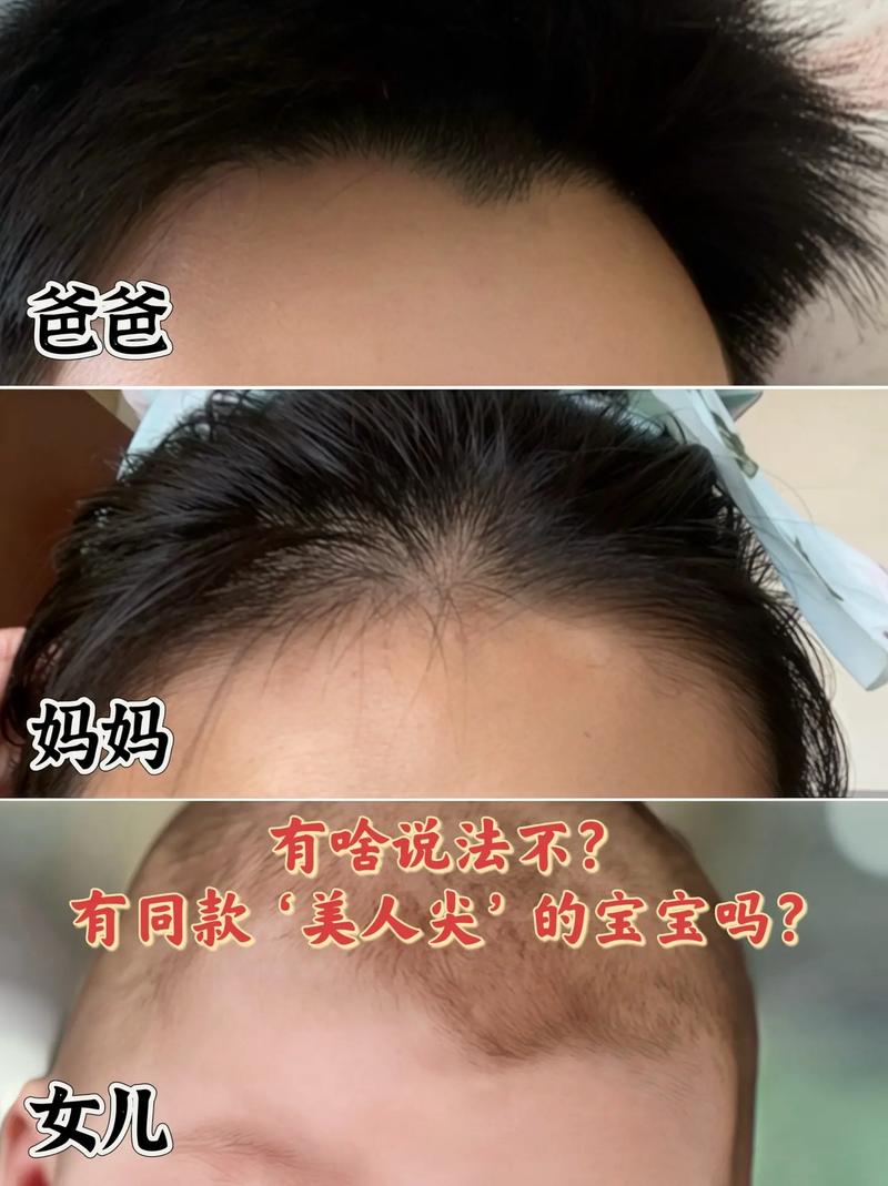 美人尖有什麼好處