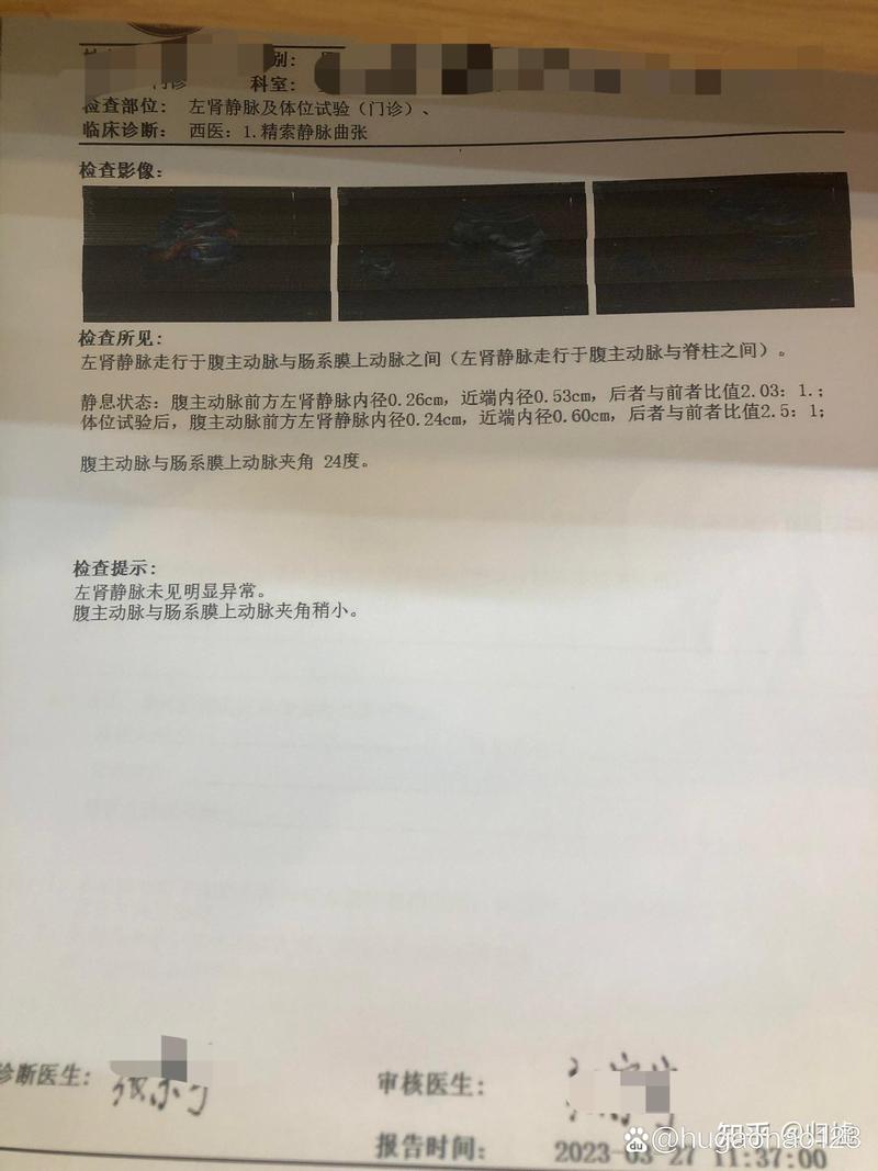 精索靜脈曲張手術多少錢:費用影響因素、健保給付與完整支出解析 3 精索靜脈曲張手術多少錢