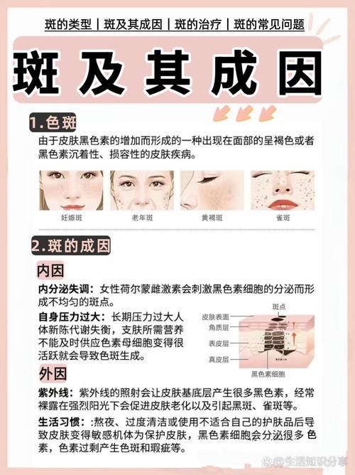 荷爾蒙斑是什麼