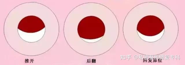 落紅怎麼辦