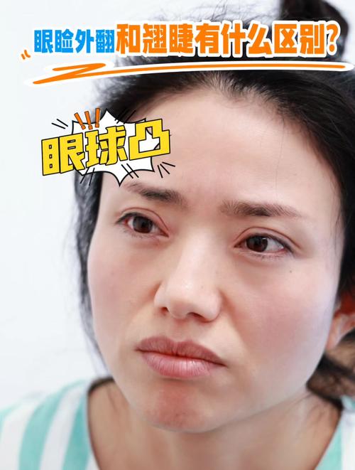 縫雙眼皮可以種睫毛嗎