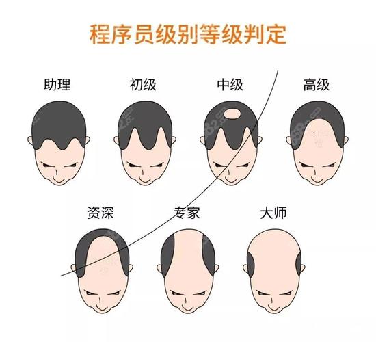 如何判斷自己會不會禿頭:警訊、症狀與自我評估指南,及早發現及早應對 3 如何判斷自己會不會禿頭