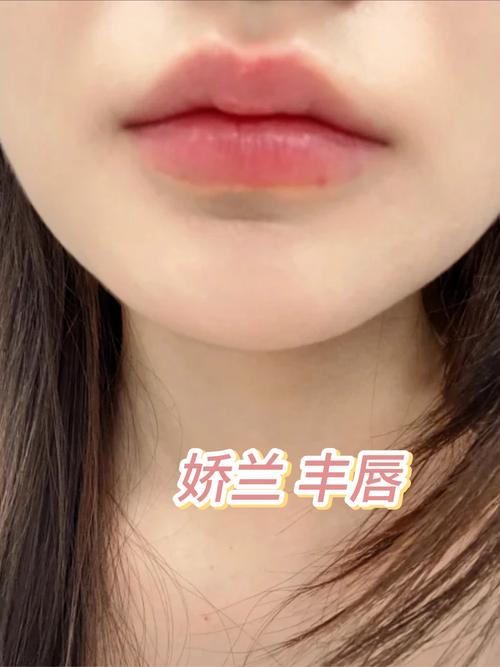 嘟嘟唇 痛嗎