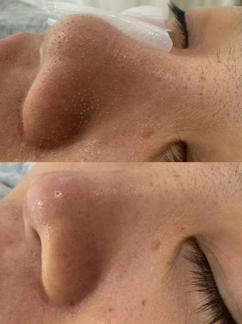 為什麼人工皮會白白的:深入解析人工皮變色之謎與使用指南 1 為什麼人工皮會白白的