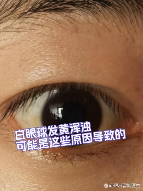 眼球是什麼顏色的