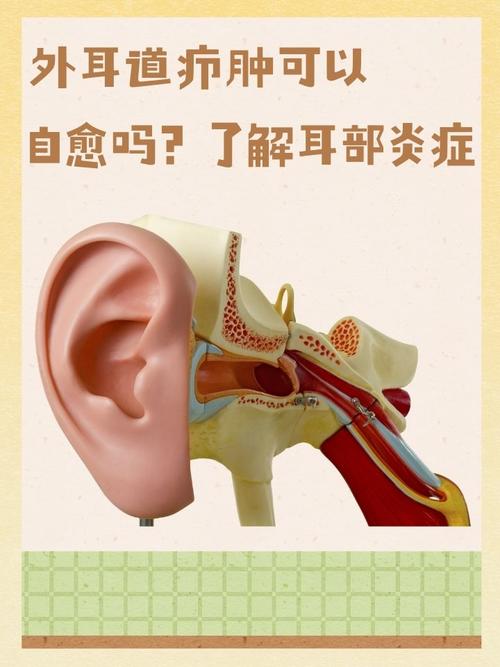 耳朵流膿怎麼辦耳朵流膿的詳細原因、症狀、處理方式與預防策略 3 耳朵流膿怎麼辦