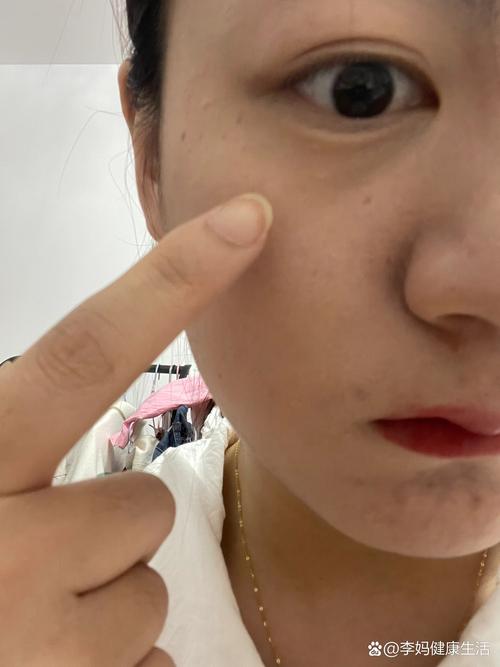 為什麼眼睛下面有一條線