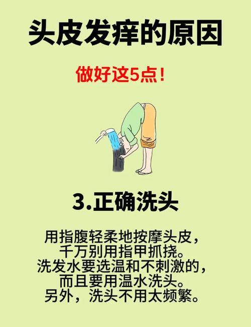 如何改善摳頭皮:從根源到解決方案的全面指南 1 如何改善摳頭皮