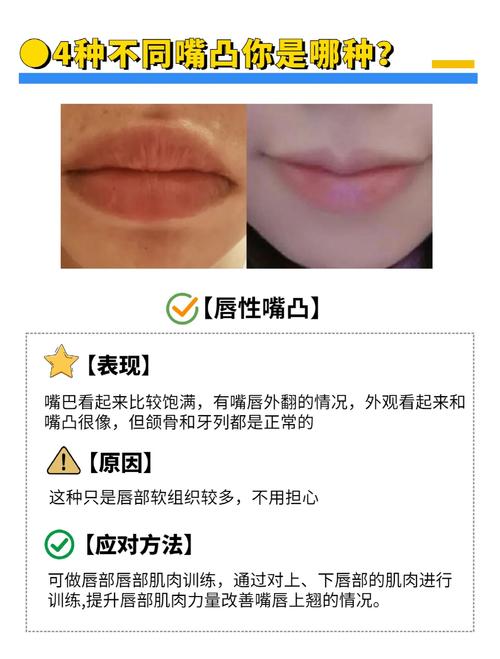 嘴凸怎麼辦