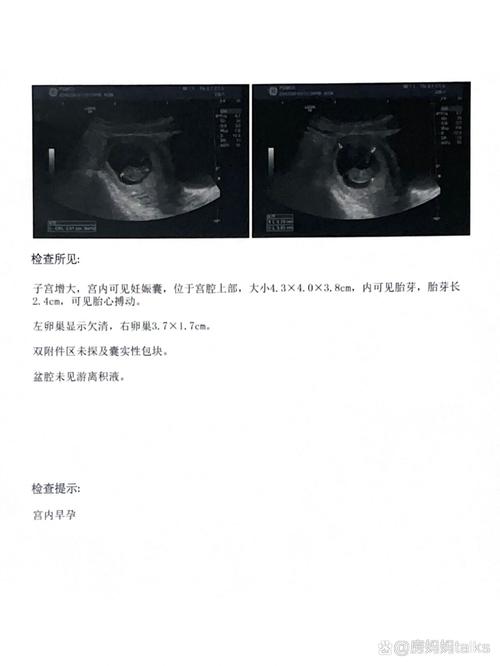 8週是幾天:從數字到實踐,讓時間規劃更精準! 1 8週是幾天