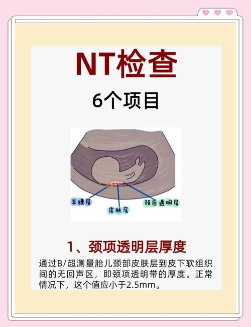 NT 幾週