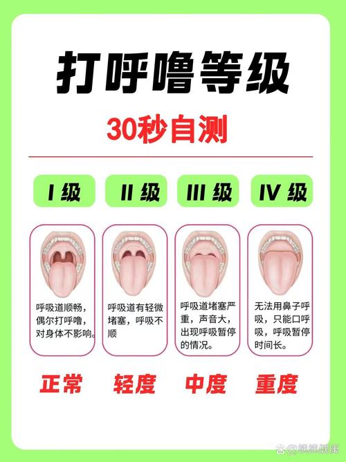 男生為什麼比較容易打呼