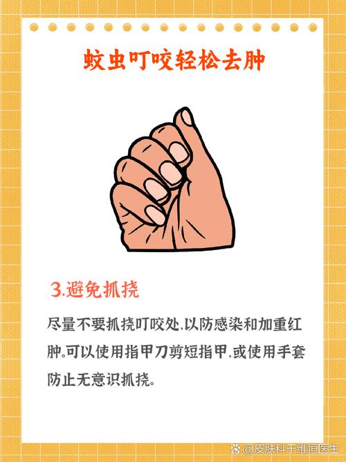 蚊子叮如何止癢