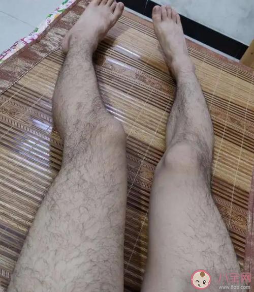 腿毛會自己掉嗎