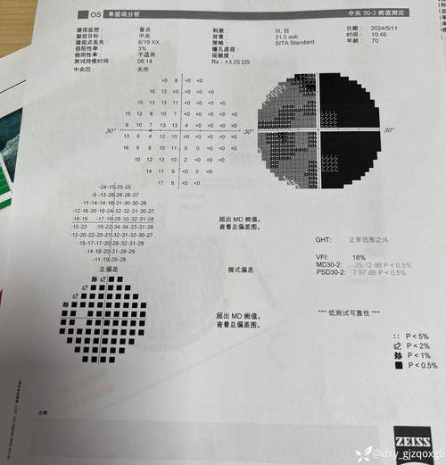 一般人視野幾度