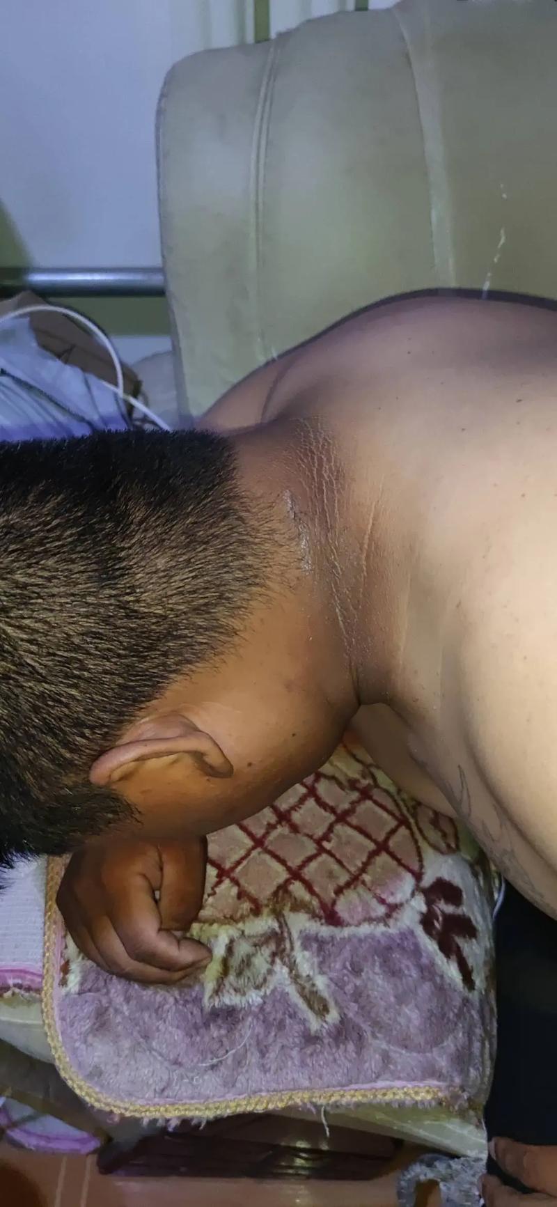 脖子曬黑:告別「雙色人生」!全方位預防與修復脖子色差的權威指南 3 脖子曬黑