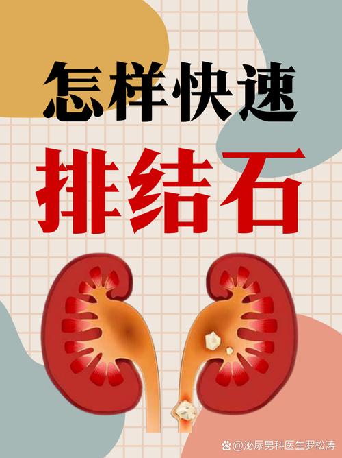 如何讓結石排出:從日常飲食到醫療介入的全方位指南 1 如何讓結石排出