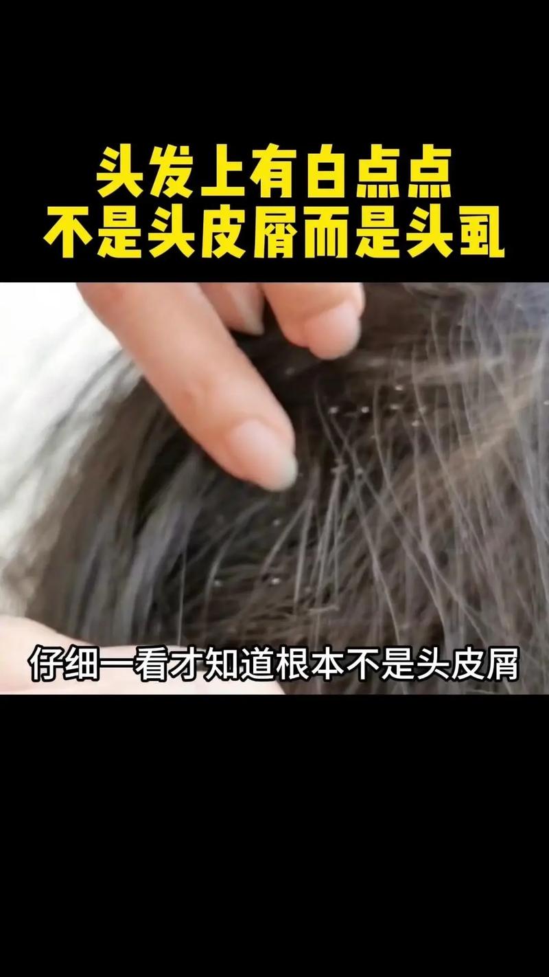 跳蚤會在頭髮上嗎