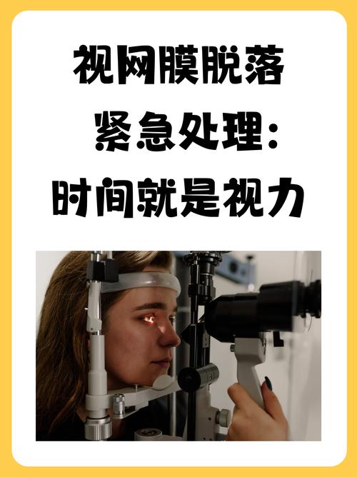 視網膜為何停更