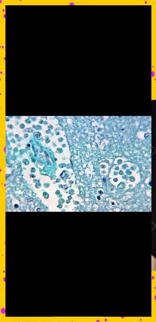 自來水有阿米巴原蟲嗎