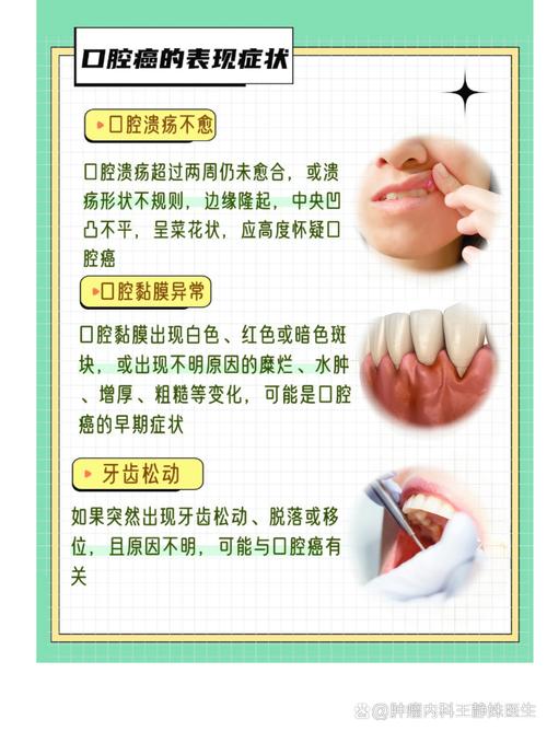 口腔癌如何篩檢