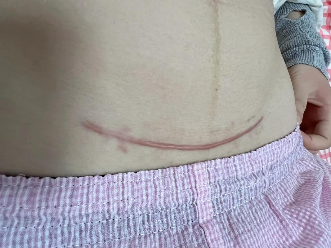 剖腹可以拍照嗎