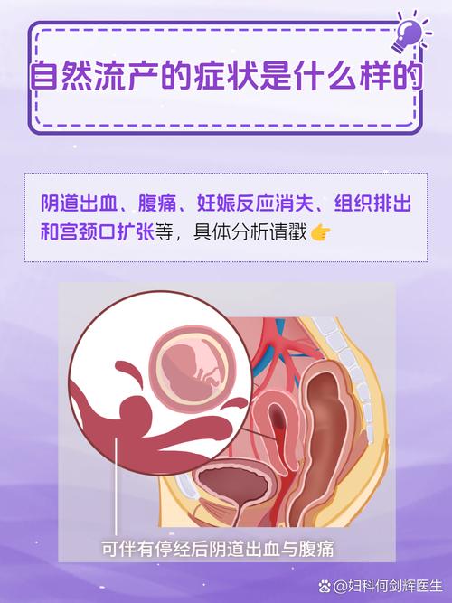 自然產幾天下床