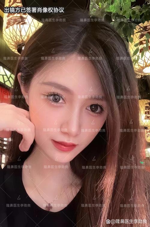 隆鼻摸的出來嗎:從觸感到視覺,深入解析隆鼻術後自然度 1 隆鼻摸的出來嗎