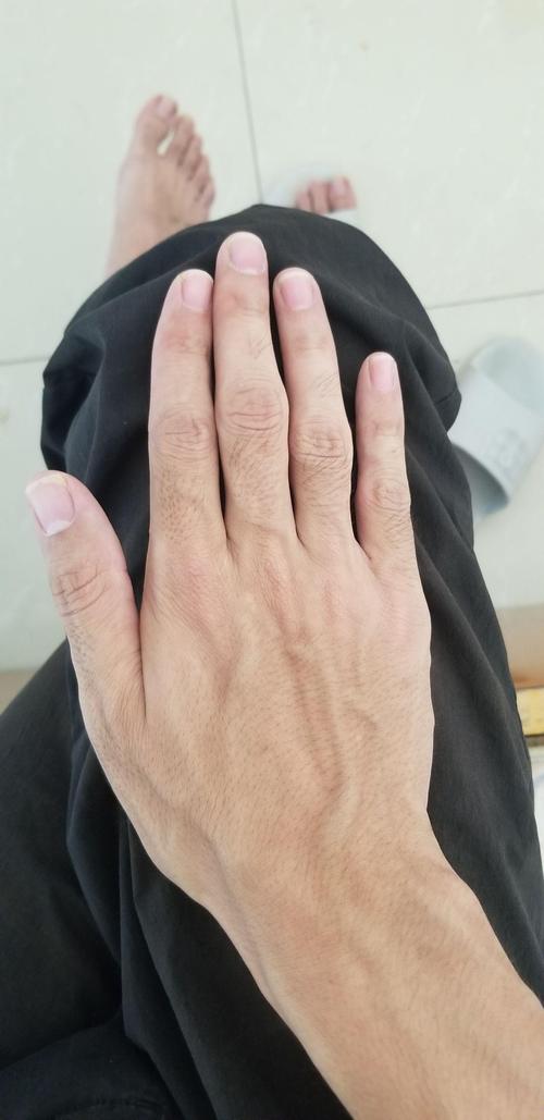 男生手毛:從生理、美觀到處理方式,一篇搞懂男士手毛的困擾與保養 3 男生手毛