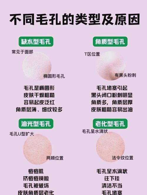 毛孔粗大怎麼變小?終極指南:從日常保養到專業療程,告別粗大毛孔、重現細緻美肌! 1 毛孔粗大怎麼變小