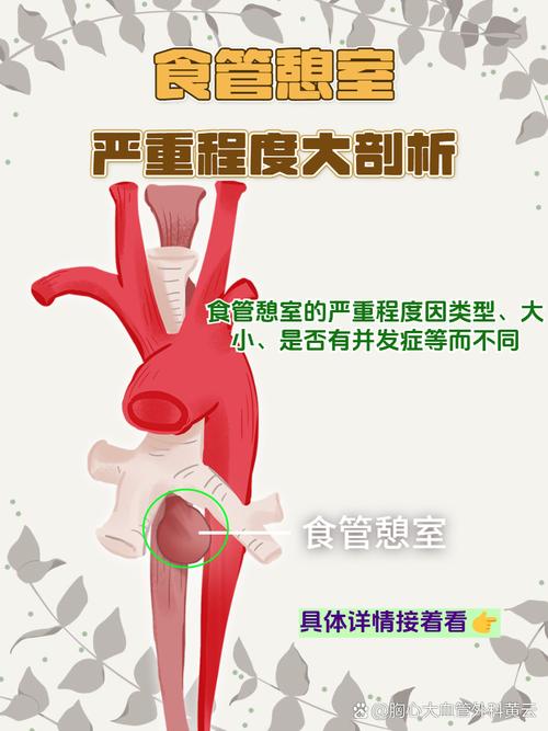 食道憩室看哪科