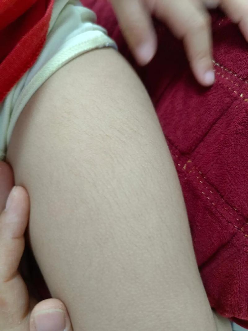 女生有腿毛是正常的嗎