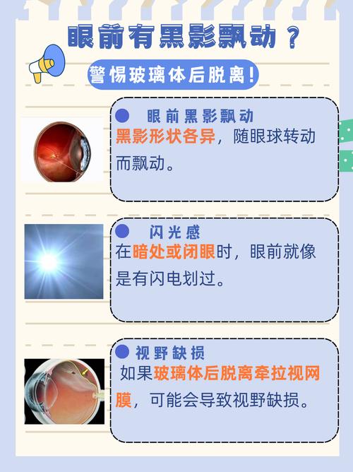 視網膜剝離會瞎嗎深度解析:失明風險、治療與視力保留的關鍵 3 視網膜剝離會瞎嗎