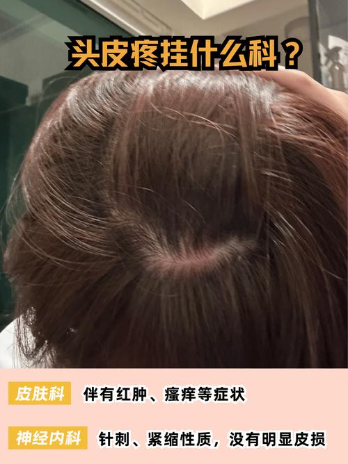 為什麼會頭皮痛