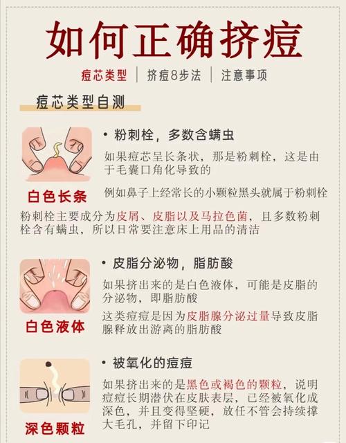 痘痘的血要擠乾淨嗎