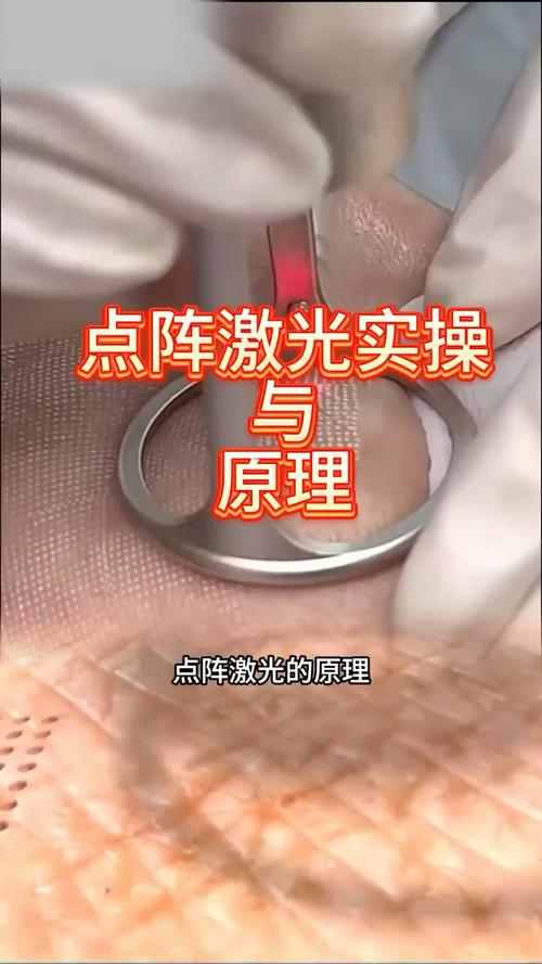 激光是誰發明的