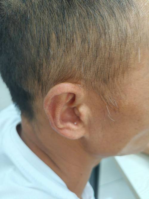 驗噪音沒去會怎樣