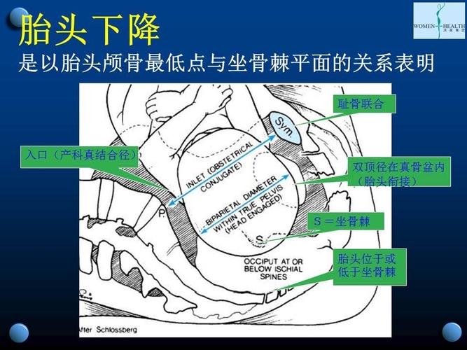 怎麼判斷胎頭下降:準媽媽必知徵兆與醫師專業判斷方法 3 怎麼判斷胎頭下降